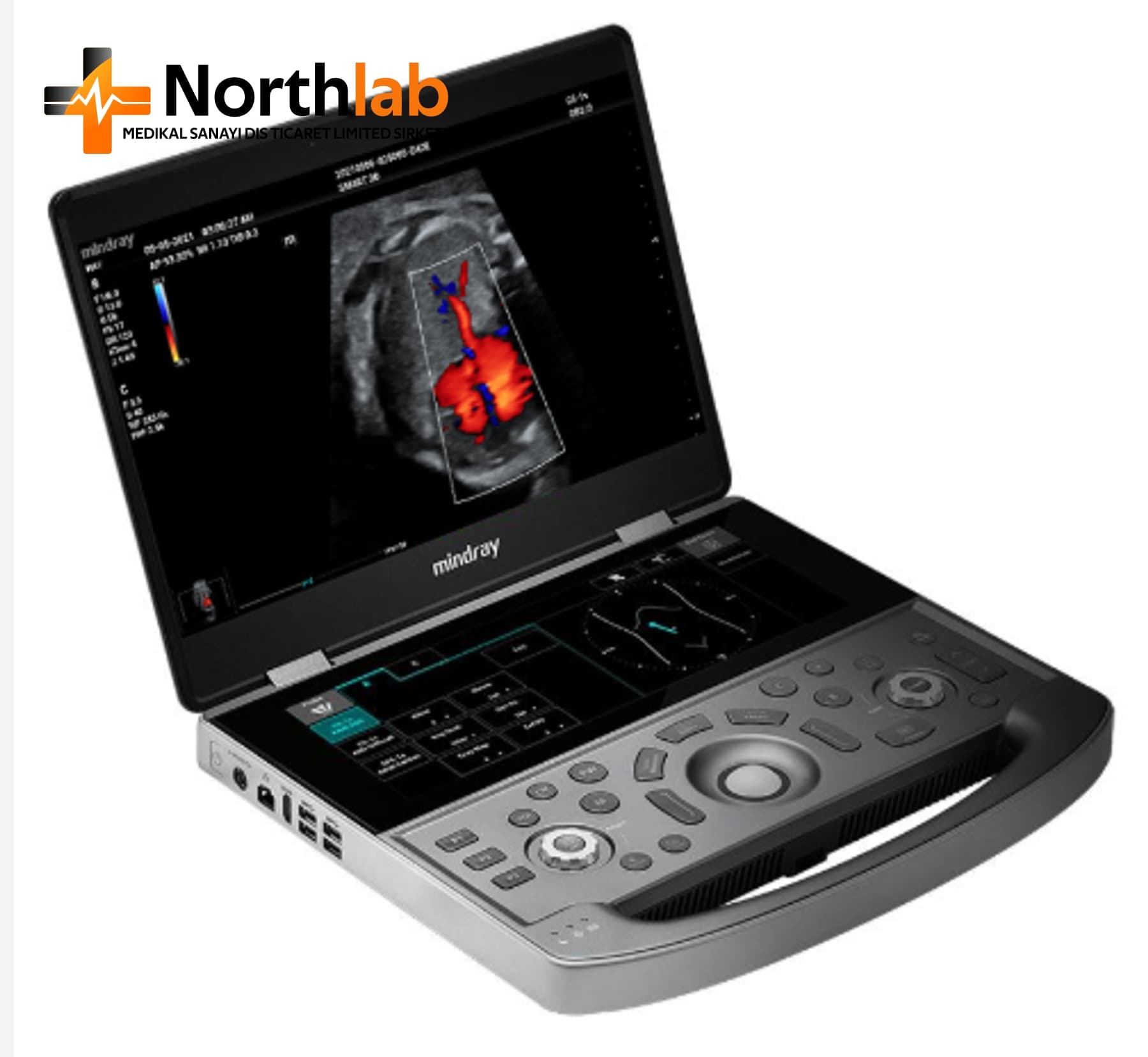 محمول Ultrasound Scanner (B/W Type)