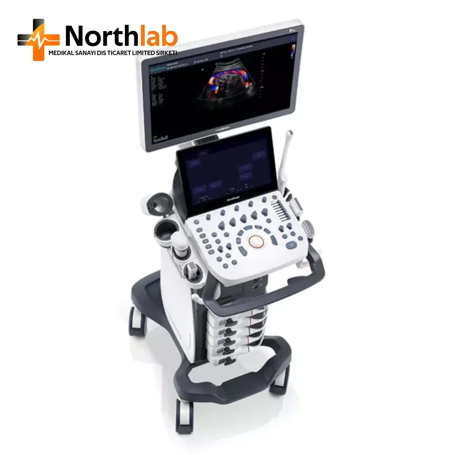 SonoScape P15 Diagnostic Ultrasound System