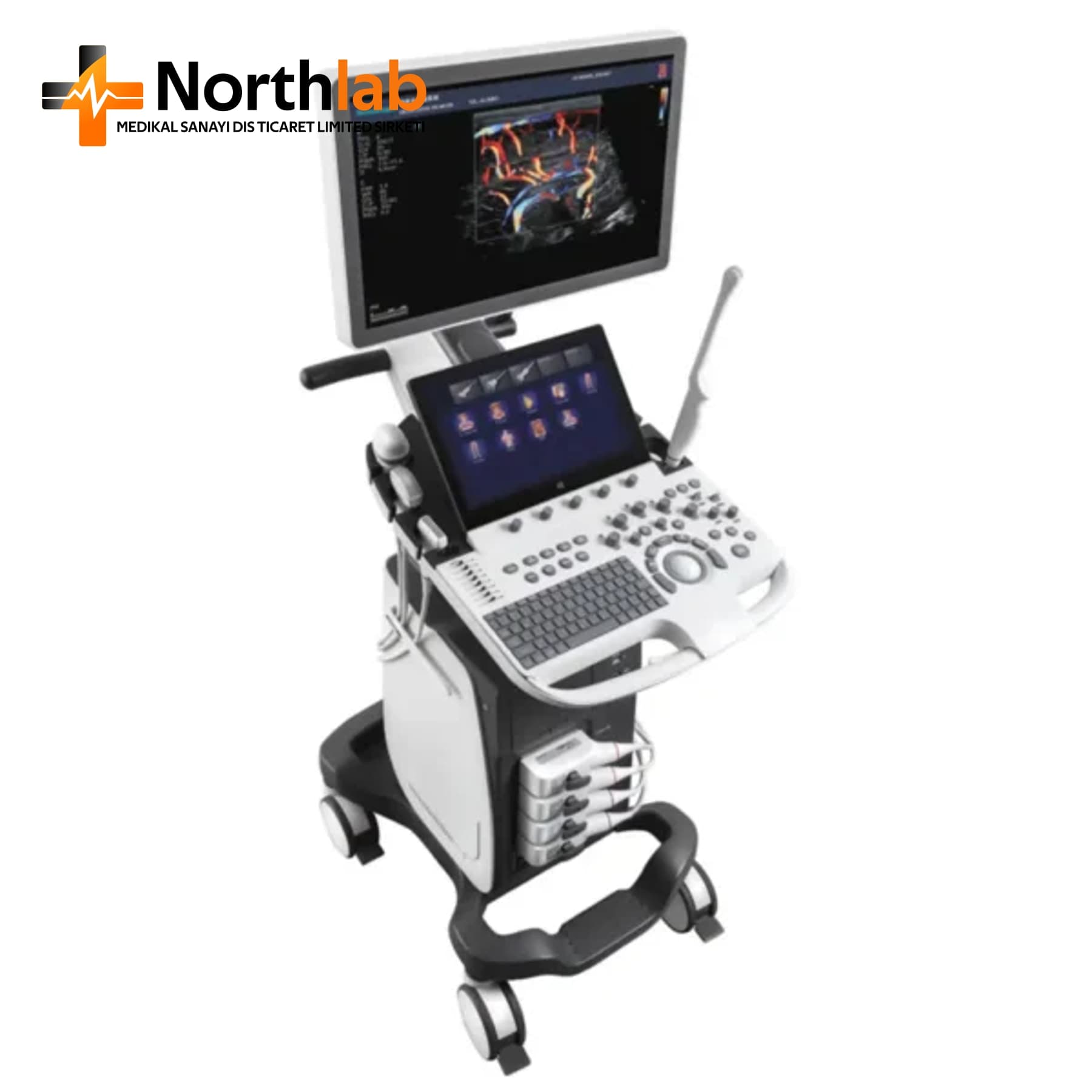 SonoScape P20 Diagnostic Ultrasound System