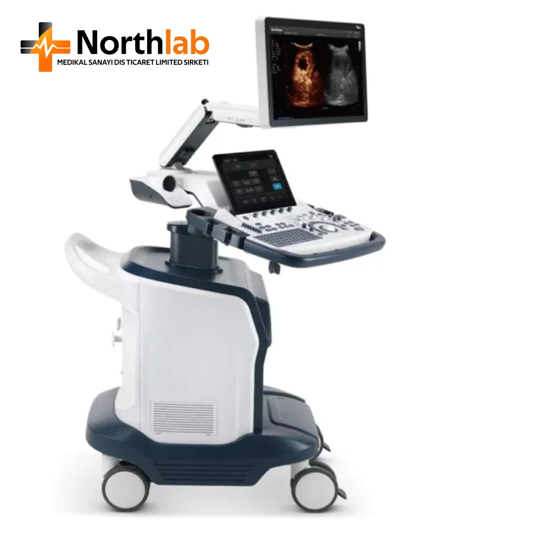 SonoScape S60 Diagnostic Ultrasound System