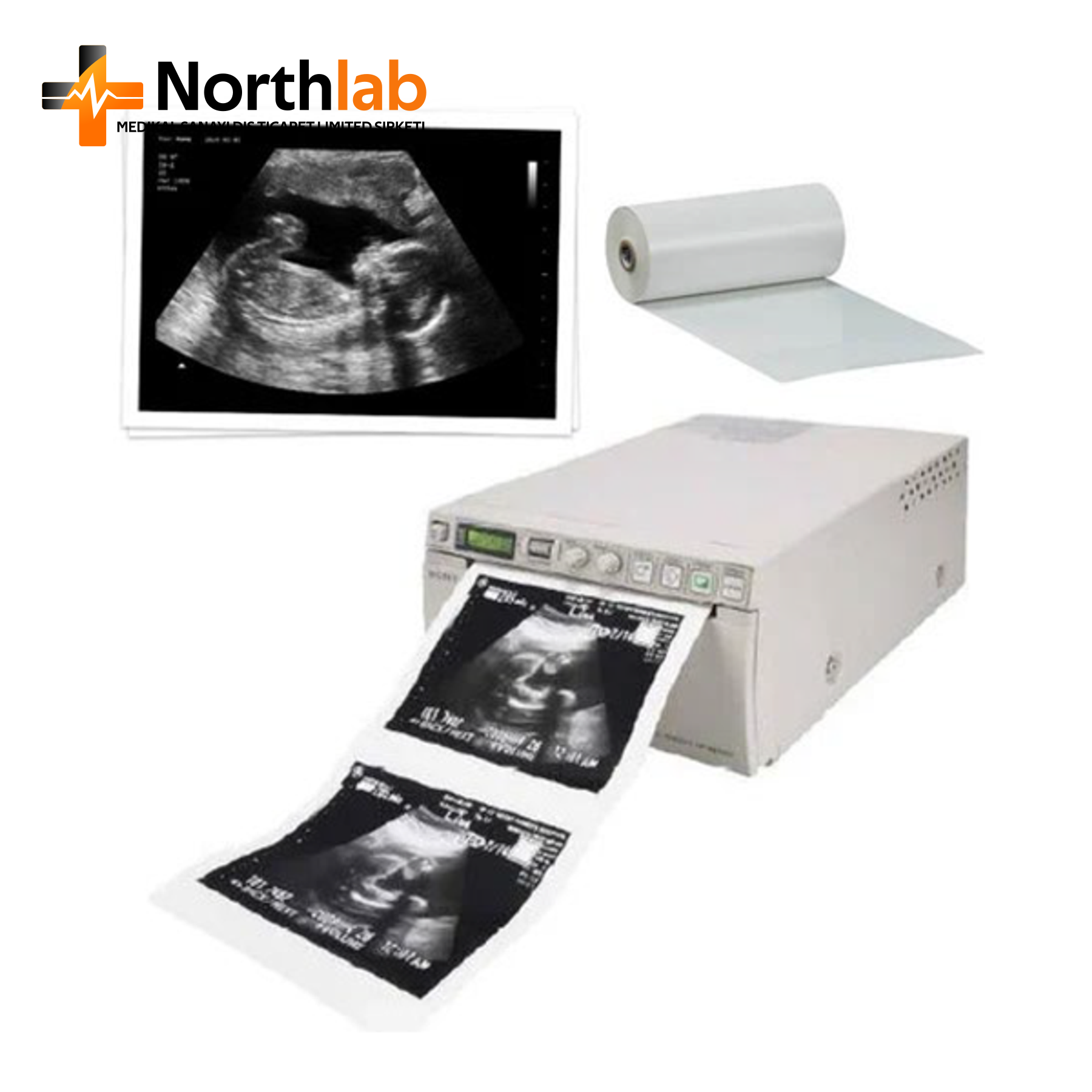 Ultrasound Printer - Black and White