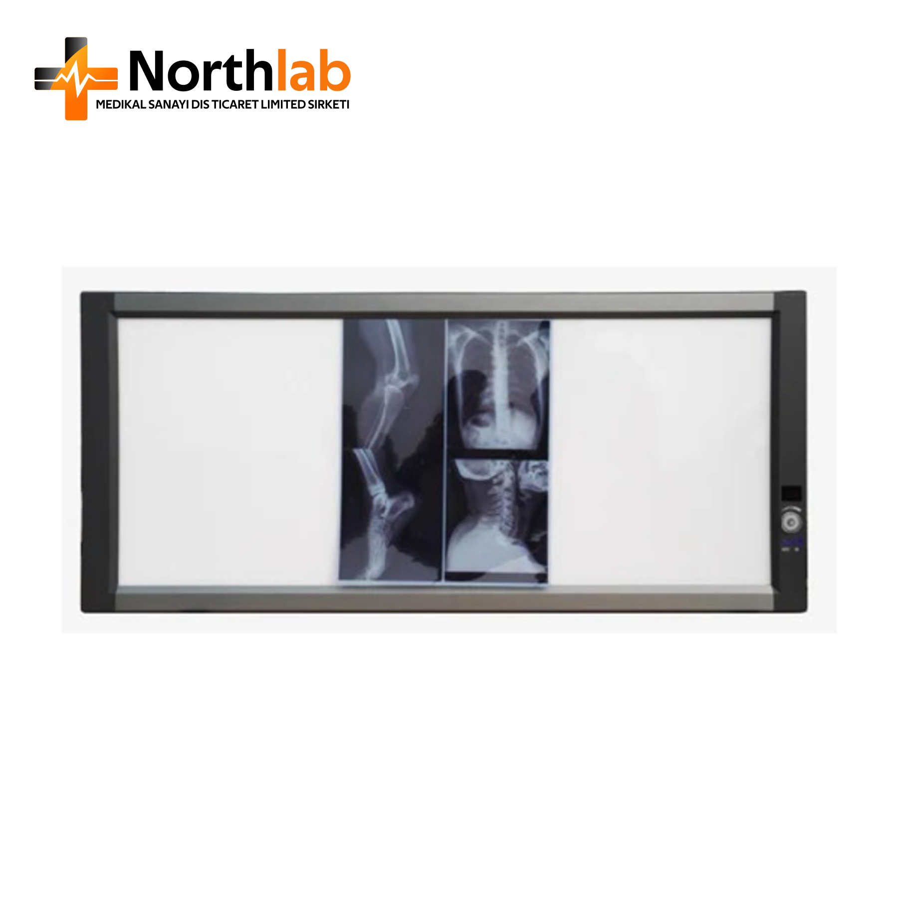 X-501 X-Ray Observation Lamp, Triple Screen